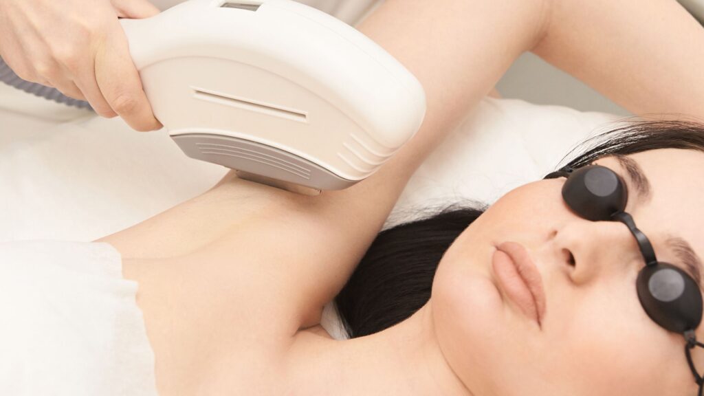 Is Laser Hair Removal Painful ?