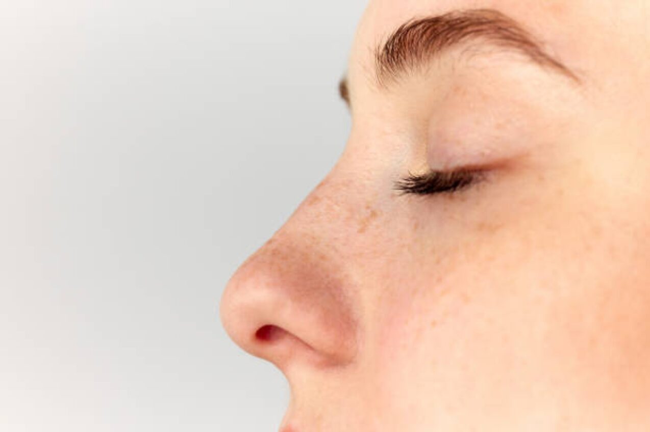 Side profile of a person’s nose, ideal for quick rhinoplasty enhancements