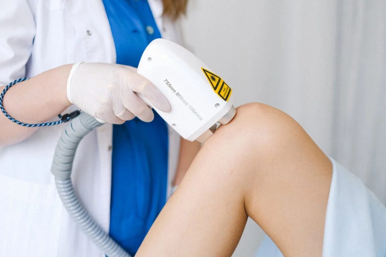 Laser hair removal procedure on leg for smooth, long-lasting results